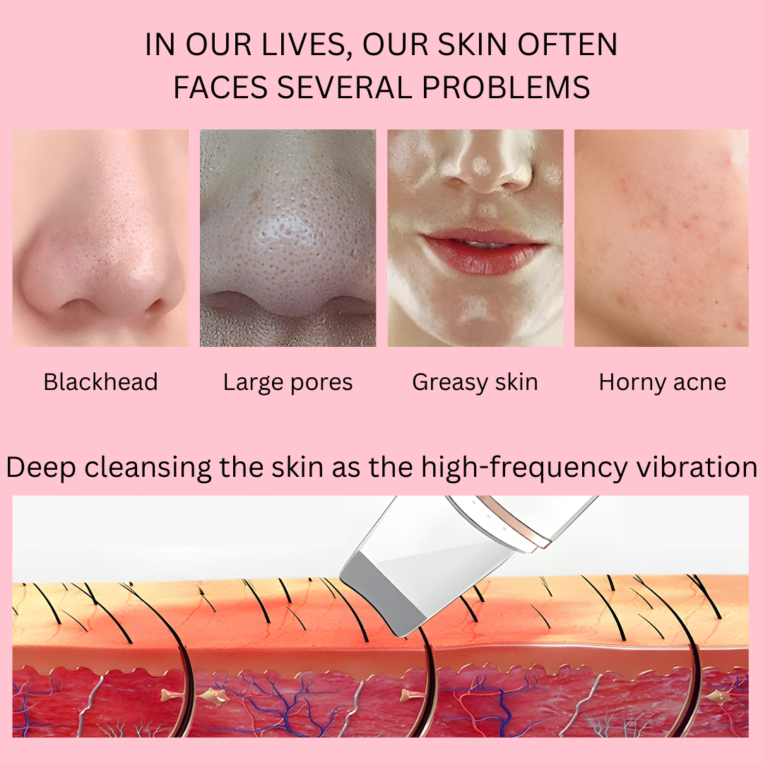 Ultrasonic skin scrubber