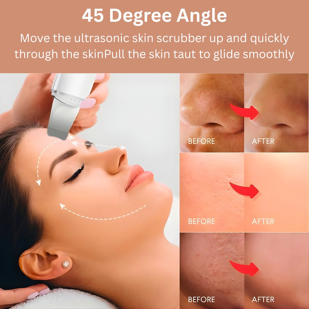 Ultrasonic skin scrubber